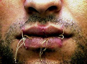 labios.jpg